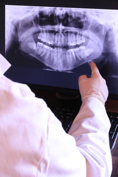 Best Emergency Dental Care for Broken or Chipped Teeth in Taylorsville, NC