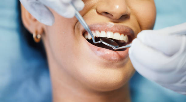 Best Emergency Dental Care for Broken or Chipped Teeth in Taylorsville, NC